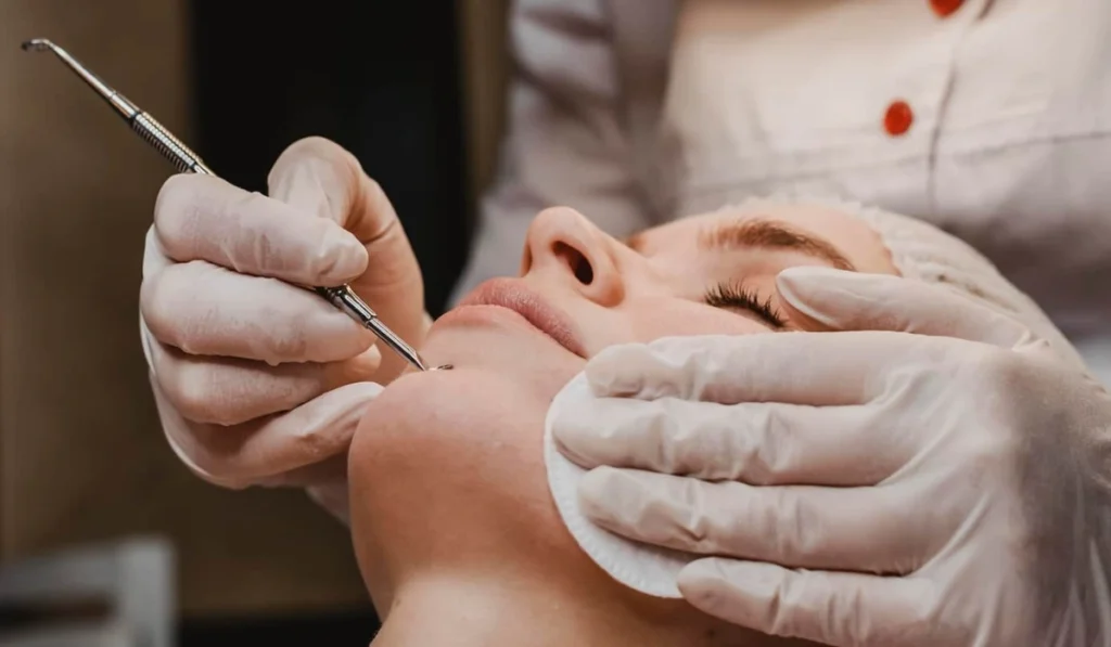 Open Pores Treatment in Gurugram
