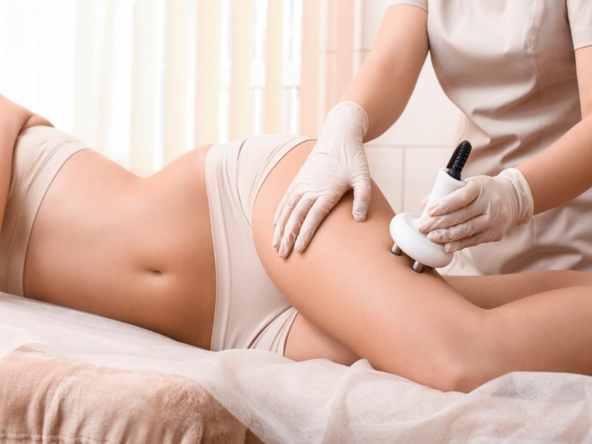 Our Advanced Cellulite Reduction Treatments at Wellness Story