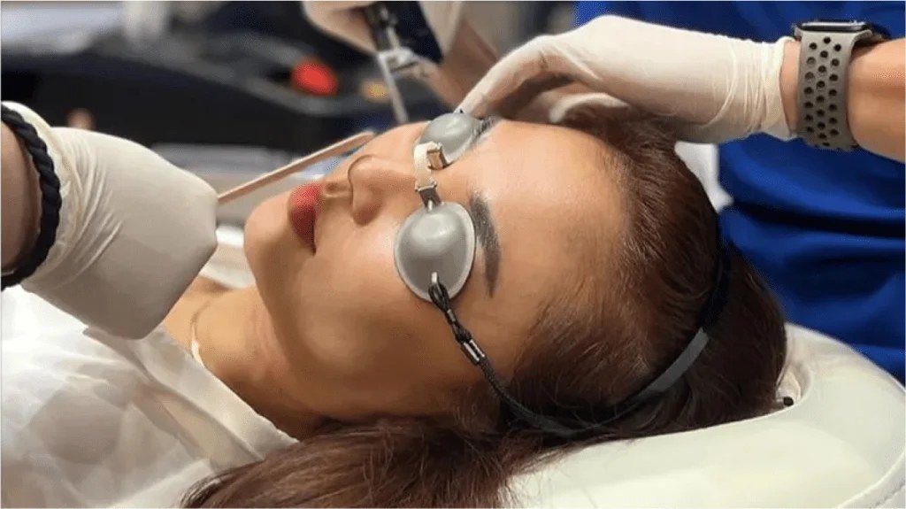 Skin Whitening Laser Treatment in Gurugram