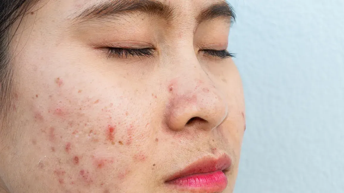 Common Urgent Skin Conditions We Frequently Consult For