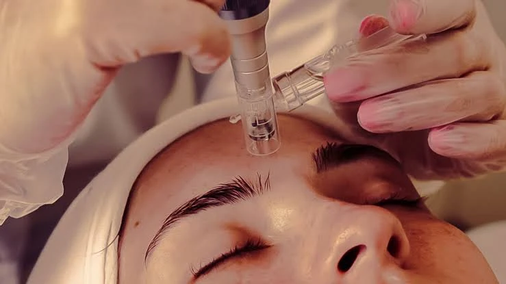 Dermatology Treatment in Gurugram