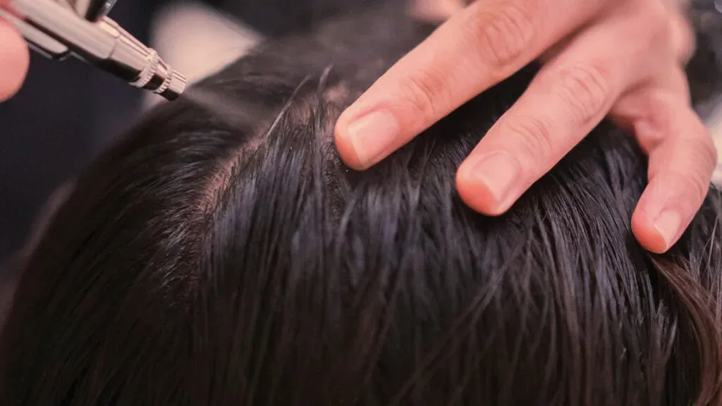 Understanding the Root Cause of Dandruff
