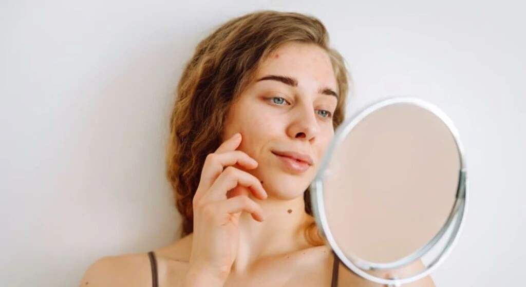 Why Do Skin Problems Always Appear at the Worst Possible Time?